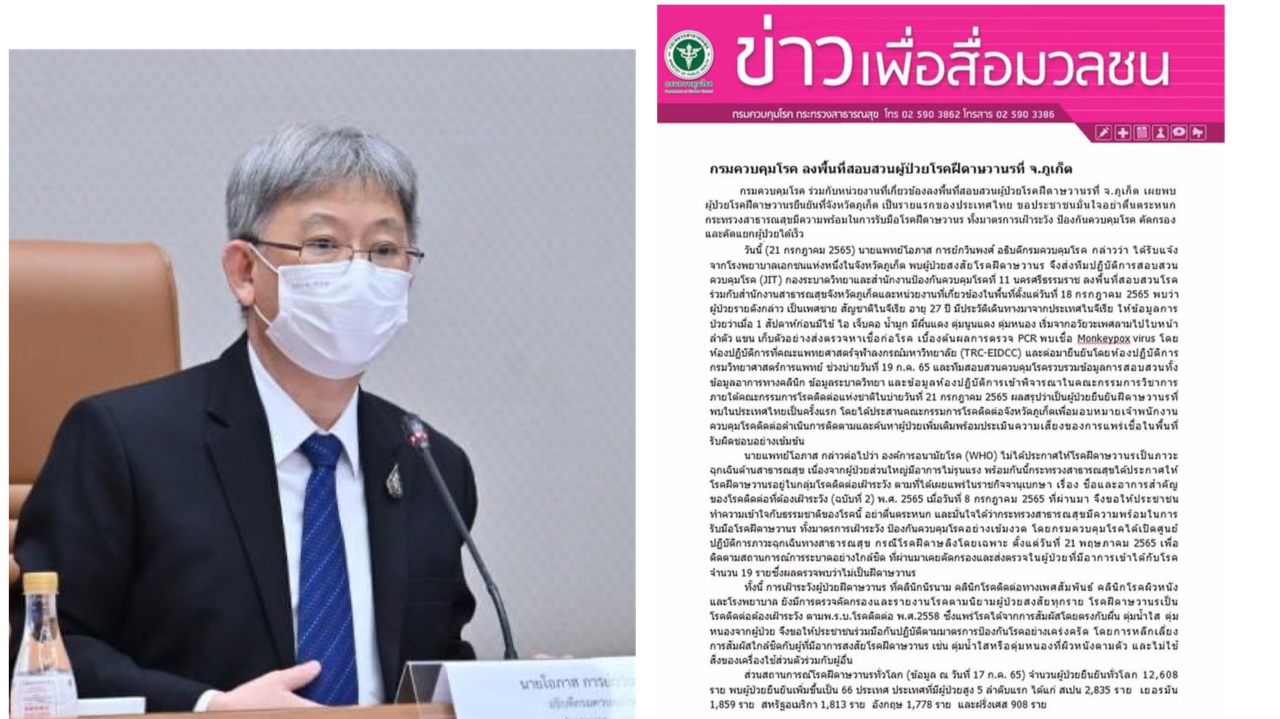 พบแล้ว! ผู้ป่วยฝีดาษลิงรายแรกของประเทศที่จ.ภูเก็ต กรมควบคุมโรควอนอย่าตื่นตระหนก ยันพร้อมรับมือ 1 75417646 6CEF 49B0 9202 C45B4BAEC4D8