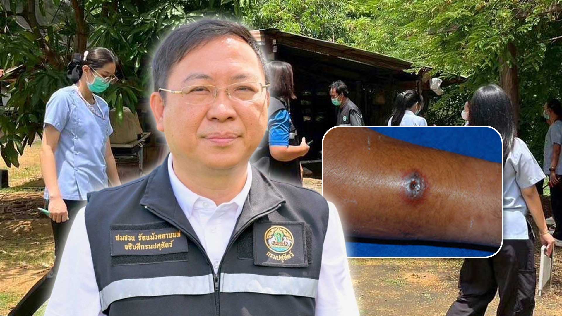 ปศุสัตว์สระแก้วร่วมสอบสวนโรค “แอนแทรกซ์” หลังพบผู้ป่วยยืนยันรายแรกของจังหวัด ซักประวัติพบ ผู้ป่วยชอบกินก้อย ซอยจุ๊ เนื้อดิบ 1 ปศุสัตว์สระแก้ว3 แก้